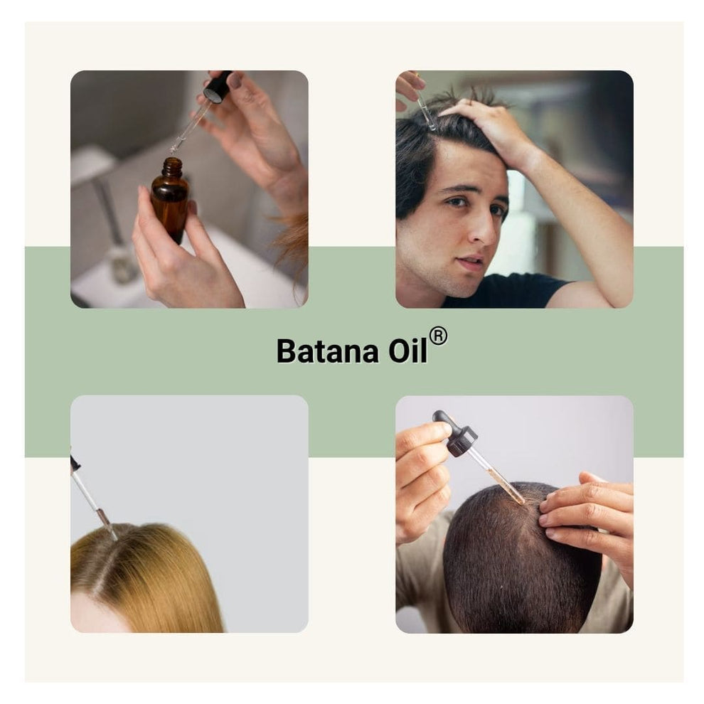 BATANA OIL® - Aceite de Batana para el crecimiento del cabello